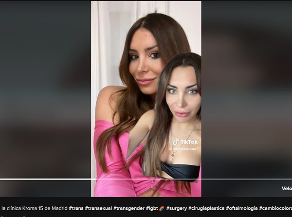 Cambiarse el color de los ojos con finalidad estética no es seguro