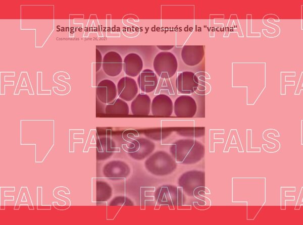 Las vacunas no pueden alterar la forma de las células de la sangre