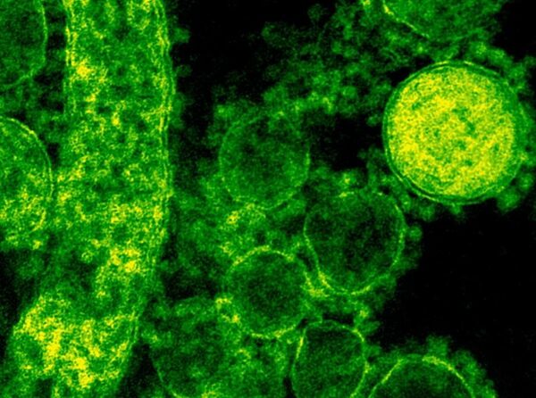 Compte amb els missatges que neguen l’existència dels virus amb l’argument que són massa grans per penetrar les cèl·lules